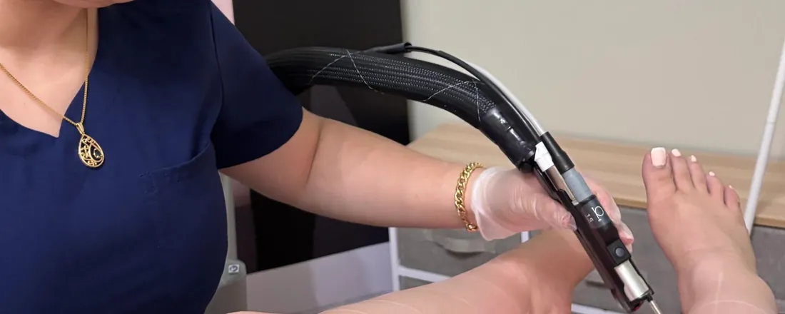 Laser hair removal on a client's lower legs